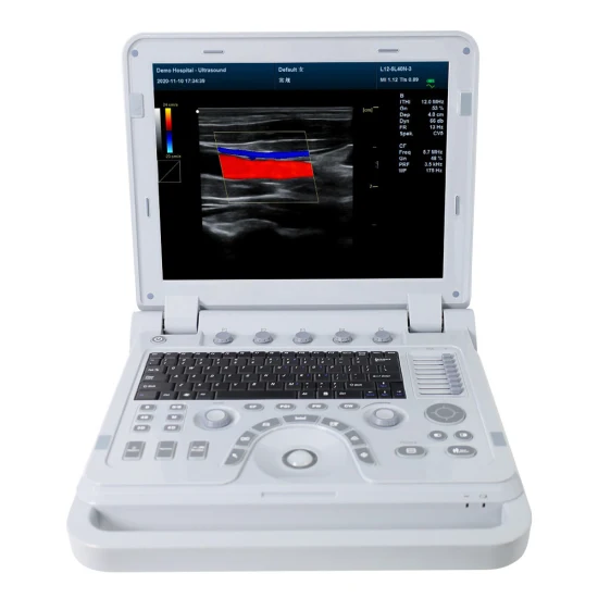 Contec Hospital Equipment Color Doppler Ultrasound Diagnostic System