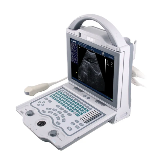 Durable/ Functional/ Affordable B/W Ultrasound Scanner for Human (KX5600)