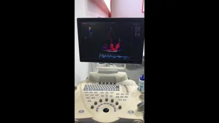 Clinic Diagnostic Cheap 4D Trolley Color Doppler Ultrasound Scanner Echo Scanner