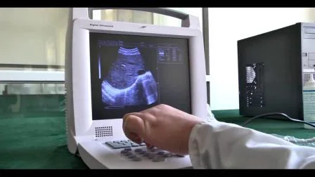 Medical Diagnosis Equipment Portable B/W Ultrasound Scanner with CE ISO